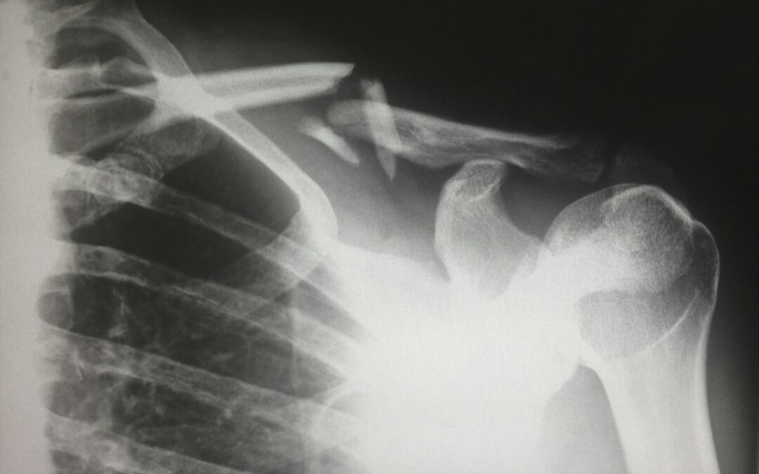 Understanding Injuries: The Benefits of X-rays and EKGs at In & Out Urgent Care