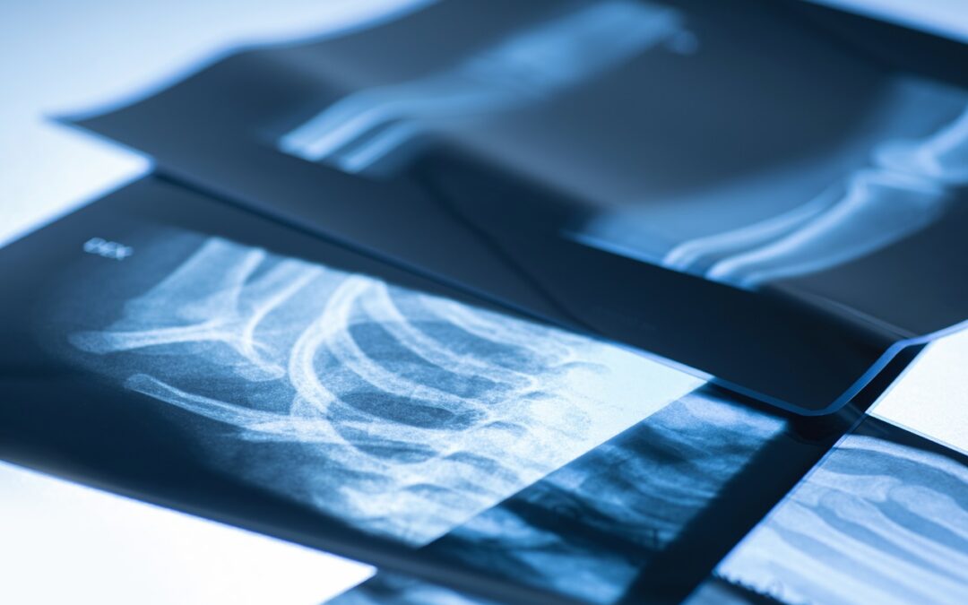 Diagnostic X-rays: A Crucial Component of Modern Healthcare and Injury Treatment