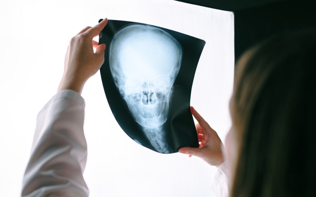 Detecting Health Issues Early with X-rays in Covington