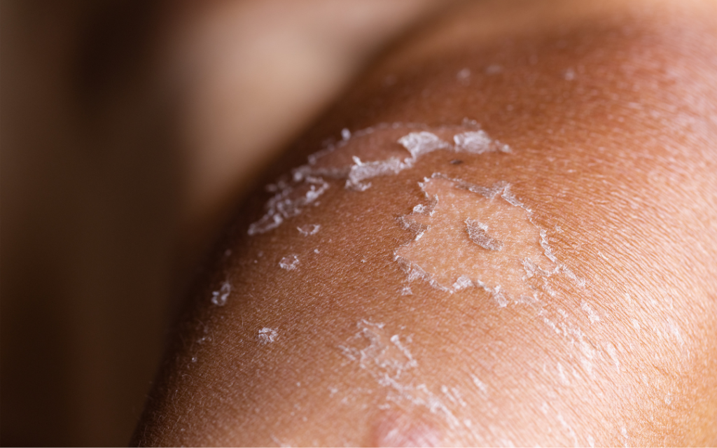 sports injury treatment